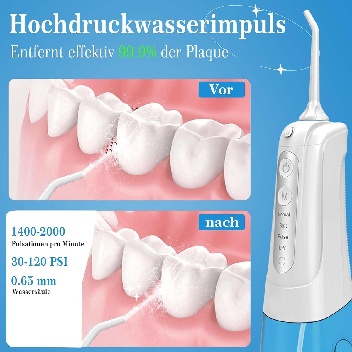 SURFOU Munddusche Kabellos – Elektrischer Water Flosser mit 4 Modi, USB & IPX7